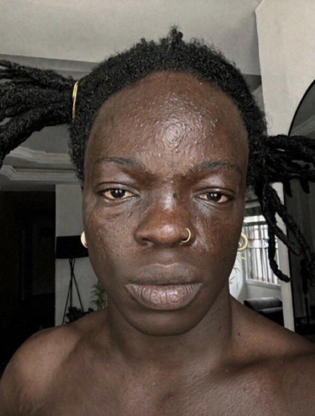 clever301's tweet photo. Rare pic of him before smoking took over

BEFORE                                             AFTER https://t.co/MaYwz4yvJG