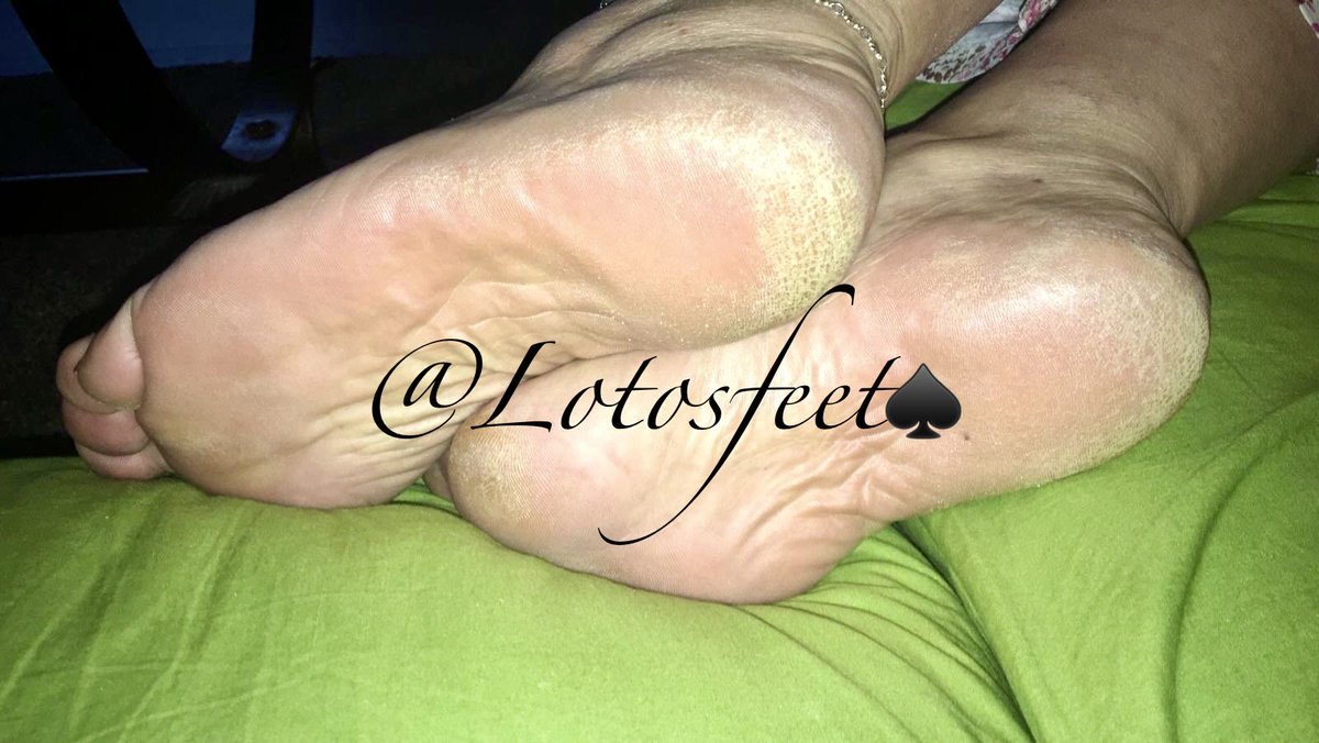 Lotos4bbc's tweet photo. #maturewife #slut4bbc #qos #feet #drysoles #hotwife #roughsoles #slutwife #bbcwhore https://t.co/53cAXIOoVp