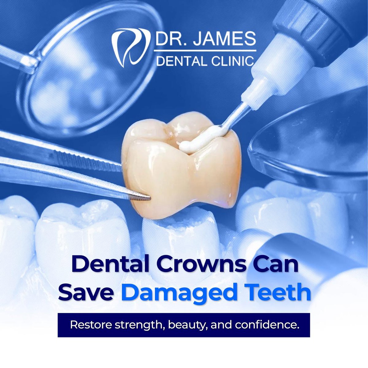 CityMallPh's tweet photo. Restore strength with dental crown from Dr. James Dental Clinic🦷😊 Visit them at CityMall Calamba✨

#CityMallPH #DrJamesDentalClinic https://t.co/ogpUGSqMgs