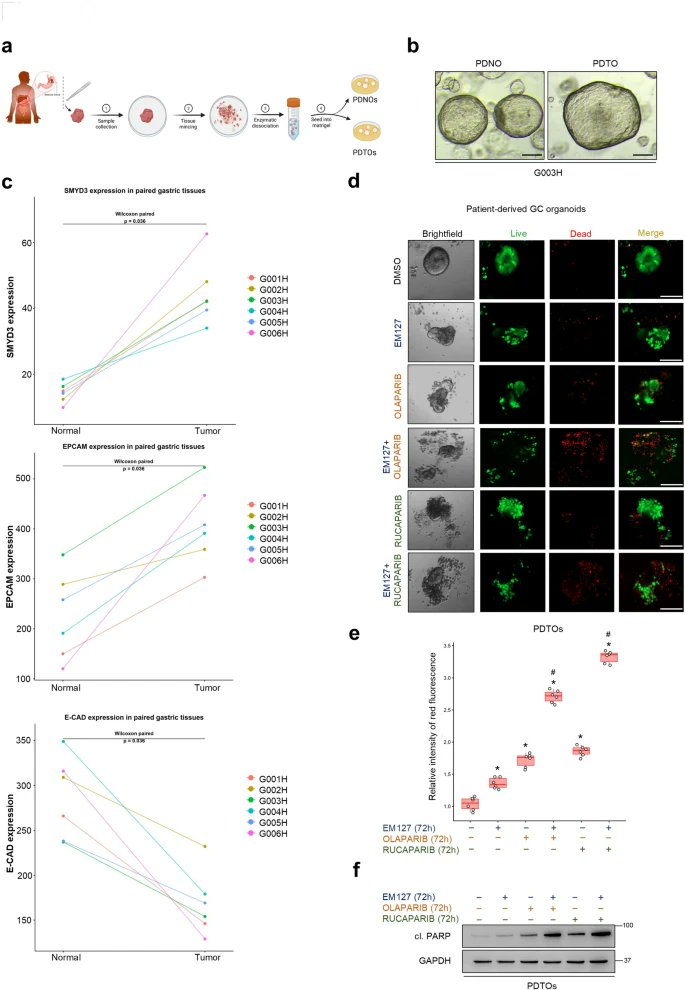 JournalofExper1's tweet photo. New!👣
Targeting the #DNArepair chromatin-modifier protein SMYD3 as a novel epigenetics-based therapy for #gastriccancer
Look here👇
https://t.co/o71dhS8oU4
#DNAdamageresponse
#HomologousRecombination
#PARPinhibitors https://t.co/OydCCLaqel