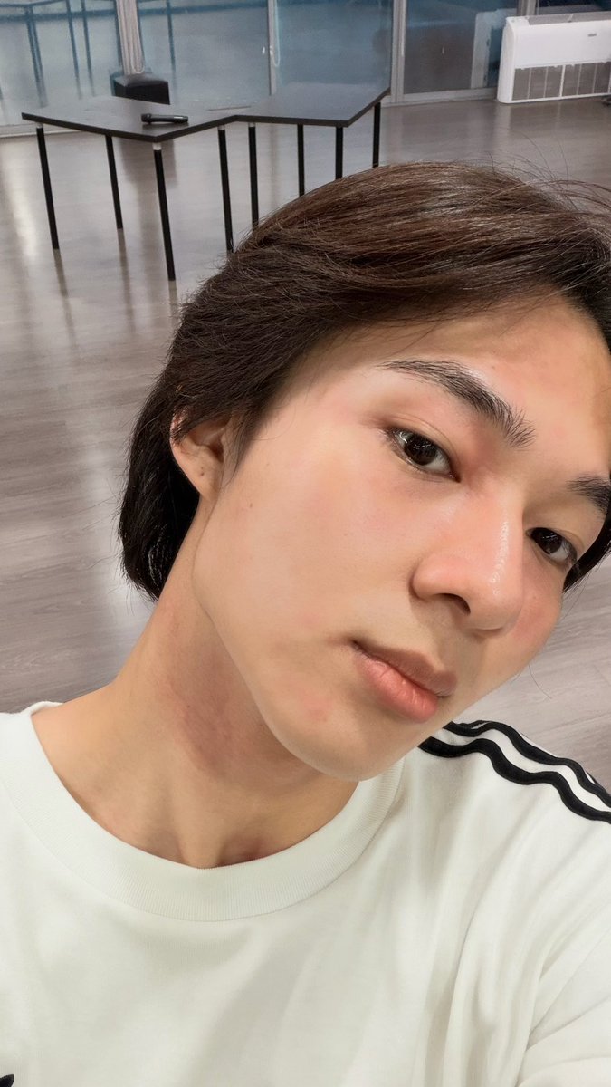 CwrNew's tweet photo. ไม่เป็นมาเกือบปี เป็นอีกแล้ว 🫩 แต่กินยาก็หายแระ 💪🏻 https://t.co/8Q17opphnA