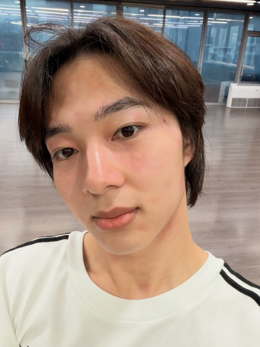 CwrNew's tweet photo. ไม่เป็นมาเกือบปี เป็นอีกแล้ว 🫩 แต่กินยาก็หายแระ 💪🏻 https://t.co/8Q17opphnA