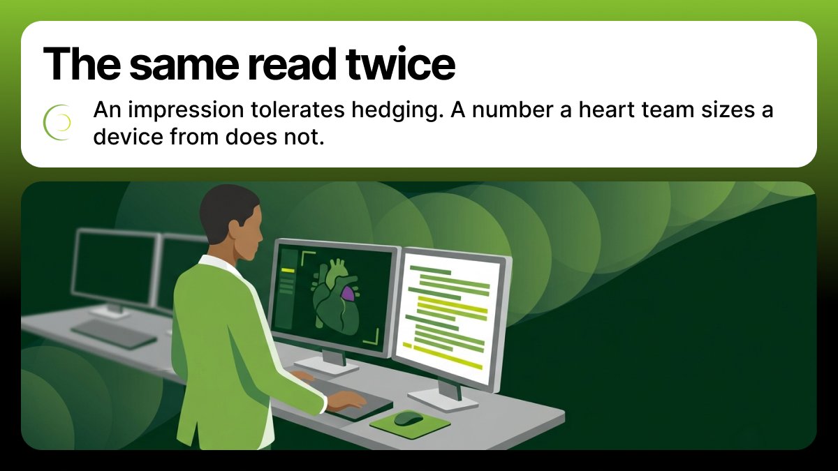 circlecvi's tweet photo. A diagnostic CT report ends in an impression. A structural planning report ends in numbers a heart team sizes a device from.

Different standard. Experience alone doesn't close the reproducibility gap.

Part 2 of our series.

#CardiacImaging 
https://t.co/TDHtNMBo9a https://t.co/ctpmEUHC0p