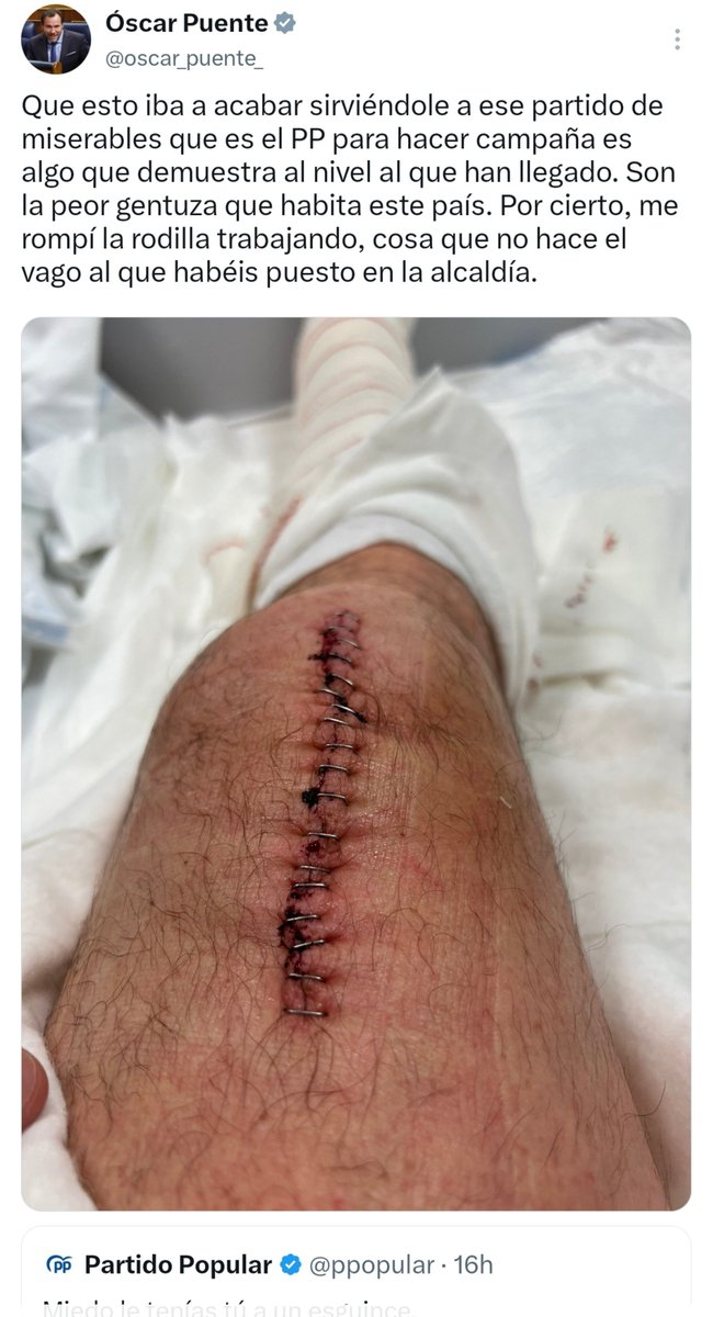 progrestonnnA's tweet photo. El abusón/matón de Twitter llorando por recibir de su propia medicina, es maravilloso 🫠 https://t.co/96nuYcwUbU