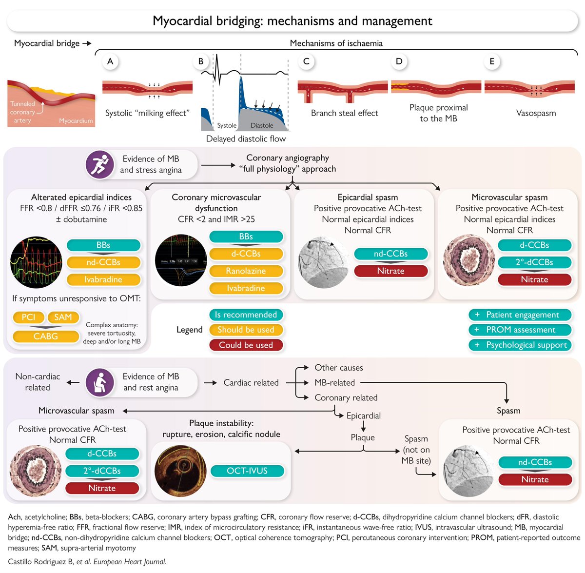 HaseebEPHF's tweet photo. 2026 EHJ - Myocardial Bridging: A Practical Guide for Clinicians
https://t.co/HHqB3B286A https://t.co/MJ2a8MdEjC