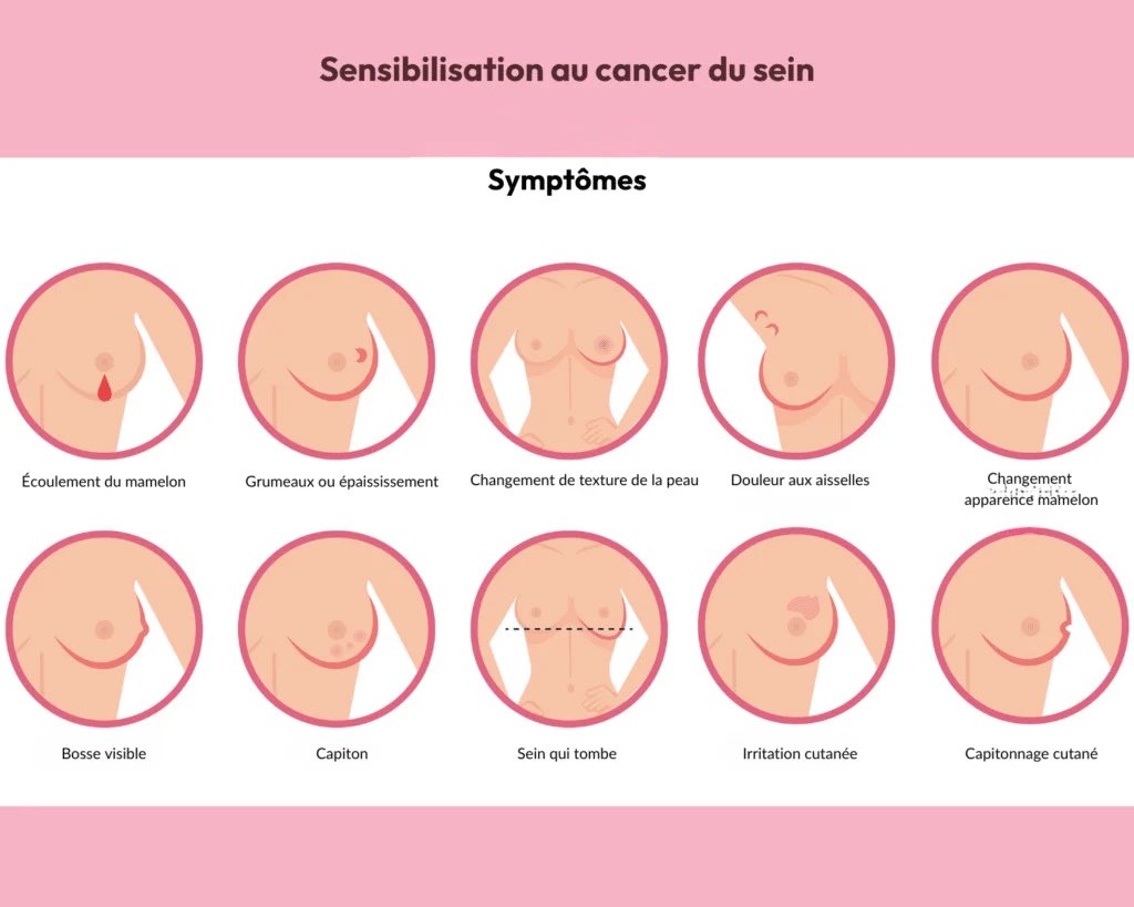 Yubilem_'s tweet photo. @Besso_N Je pose ça là pour celles et ceux qui savent pas faire d’auto palpation ! 

(Et j’en profite : les hommes aussi peuvent être sujet au cancer du sein, donc messieurs penser à aussi vérifier de temps en temps, palpez votre mamelon et vérifier la présence de masses☝️) https://t.co/NuP3d8namw