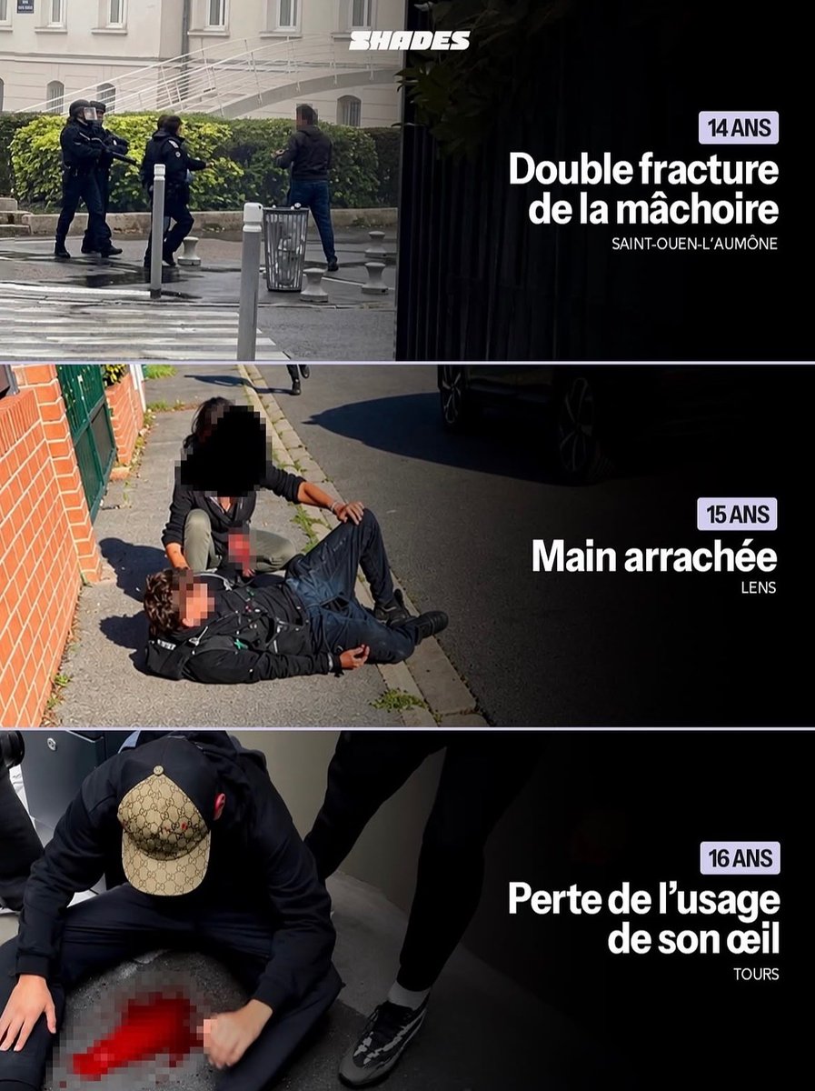 ShadesFrance's tweet photo. 🚨 Le ministre de l’Intérieur Laurent NUÑEZ affirme ne PAS avoir “à présenter des excuses” aux lycéens blessés lors d’interventions policières.

👉 Il estime aussi que les interventions se déroulent dans “la plus grande proportionnalité”. https://t.co/xqppz4nt6z