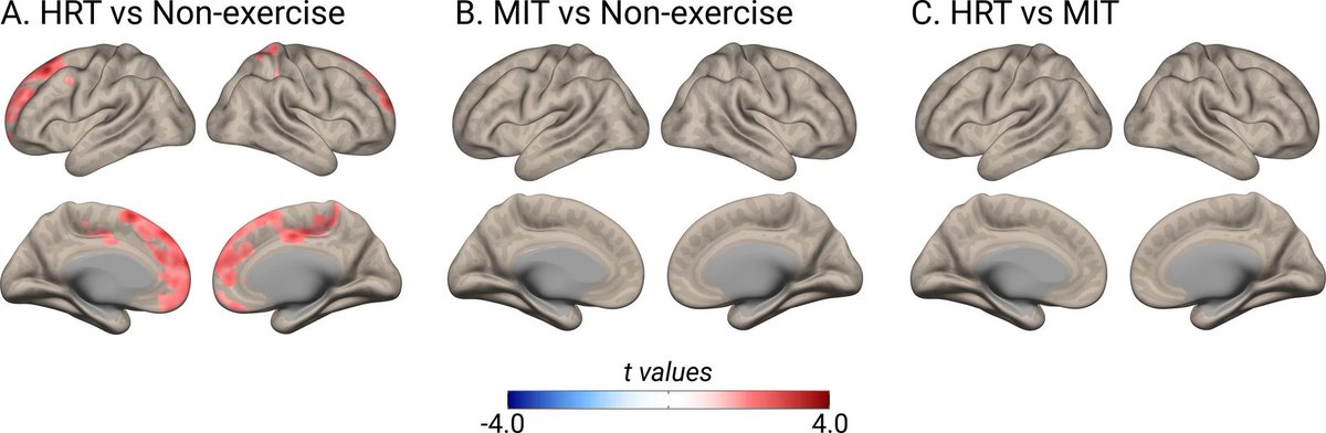 agingdoc1's tweet photo. Randomized controlled trial of resistance exercise and brain aging clocks

"Resistance exercise training decelerates brain ageing, as indexed by brain clocks, reinforcing its role as a preventive strategy for brain health."

https://t.co/Ml4nzSQlEJ https://t.co/hRIHHw4TfA