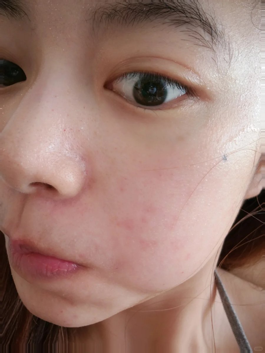 PhamChi472200's tweet photo. 最近天氣開始變涼 皮膚超敏感
我這樣的話 也會有帥哥願意顔射我嗎 https://t.co/NDwCAculCg