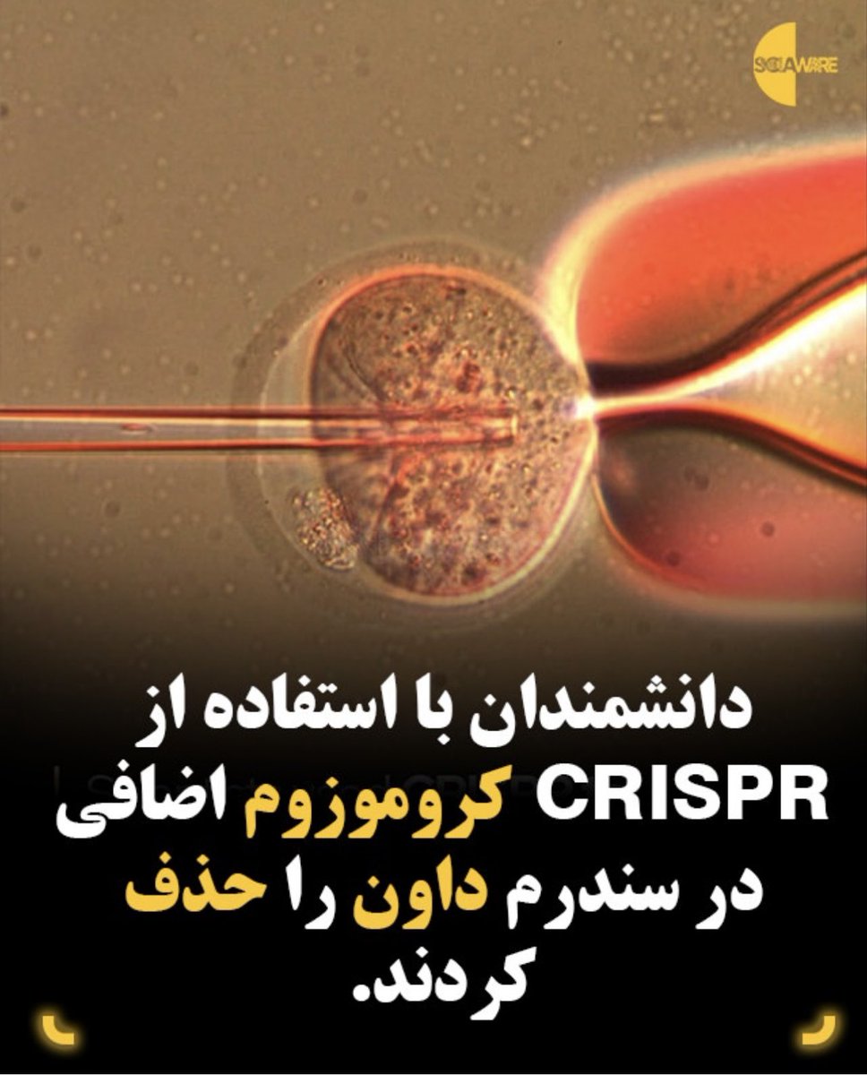 sayyedhessamali's tweet photo. و پایان سندروم داون.....
علم جواب میدهد!
ولی تو پفیوز حتما برو پیش حکیم علفی!
آفرین https://t.co/Vv8QF4qlNW