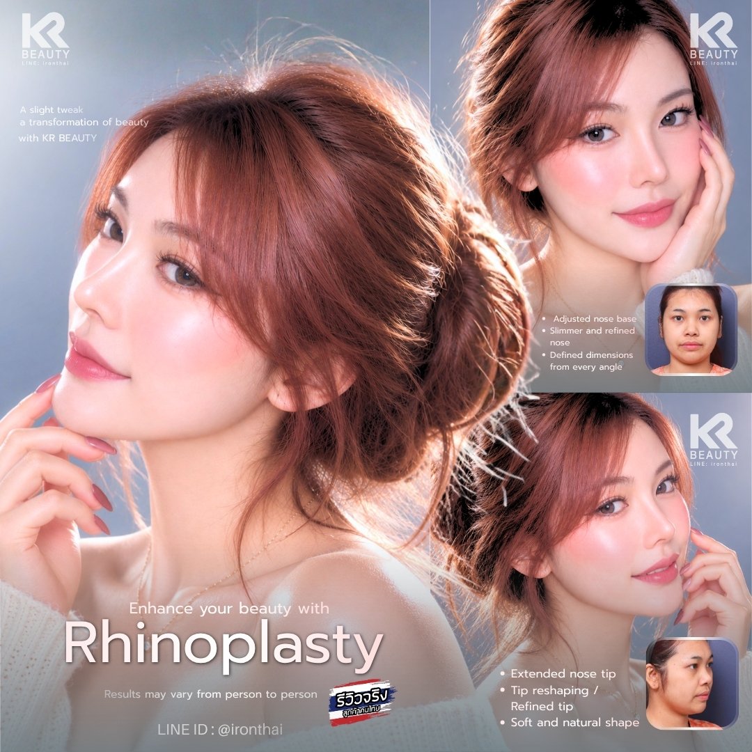 bananapsth's tweet photo. This style focuses on a soft, natural look—giving off ultimate classy and elegant vibes.
contact point provided below:
📷Line id: @ironthai
📷Whatsapp: +82-10-3453-8188
📷 010-3453-8188
#plasticsurgery #plasticsurgerykorea #eyesurgery #NoseJob https://t.co/HgwJ2CZAGX