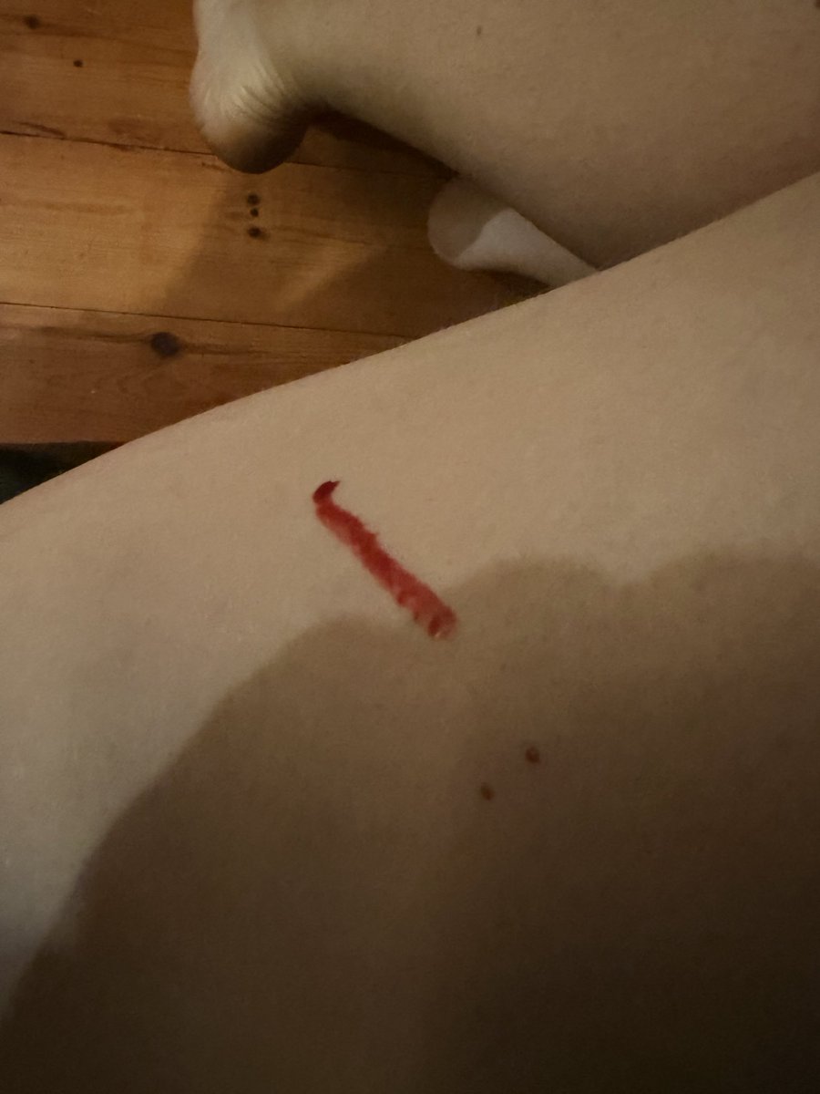 itschcu's tweet photo. Bloody injection https://t.co/PVdLFoJscf