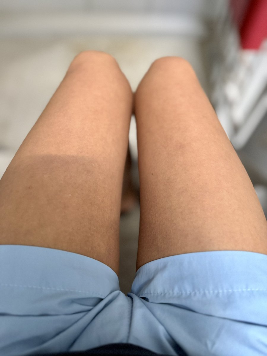 urotaz's tweet photo. 帰宅
さすがにこの格好は寒かった
#太もも　#太ももフェチ　#サンダル https://t.co/YxL5qZZm55