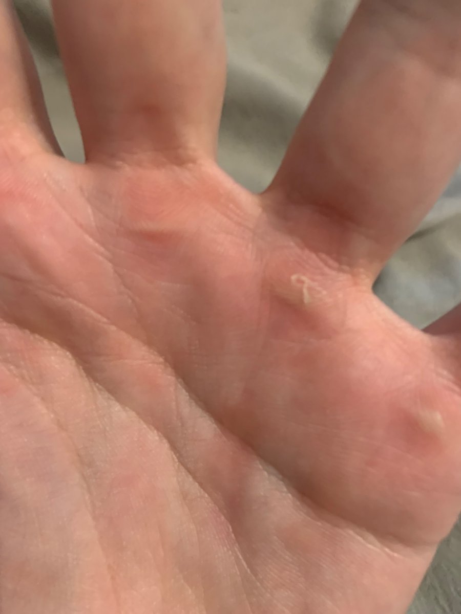 DianeGregoryy's tweet photo. @RealNightNation @RealNightNation
Where are these on your little hands boy! https://t.co/R9JmP03s1c