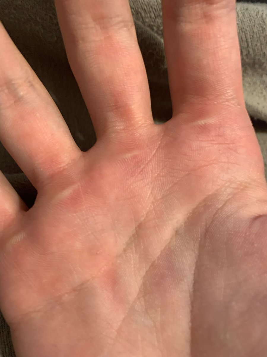 DianeGregoryy's tweet photo. @RealNightNation @RealNightNation
Where are these on your little hands boy! https://t.co/R9JmP03s1c