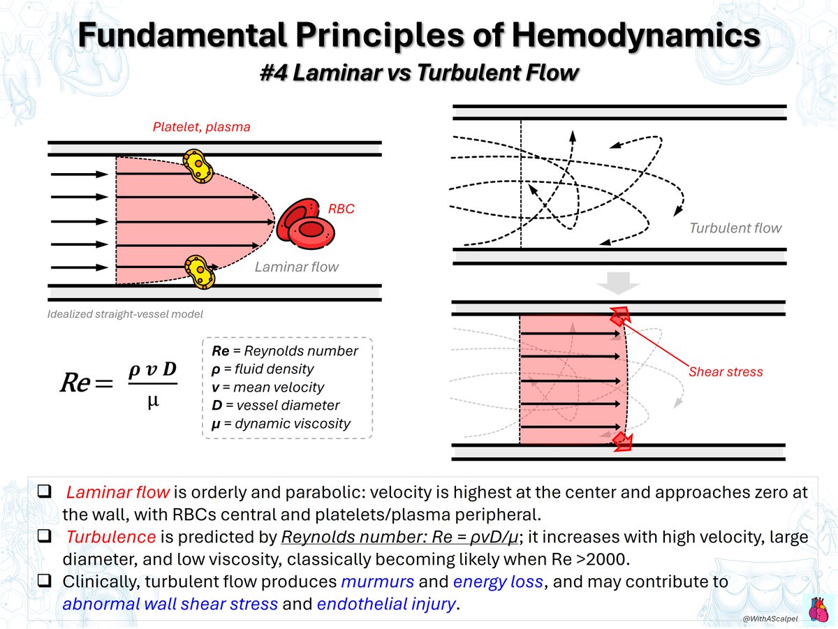 WithAScalpel's tweet photo. Fundamental Principles of Hemodynamics: Bernoulli, Poiseuille & Flow Regimes

👉Bernoulli’s principle links velocity and pressure: flow acceleration through stenosis lowers lateral pressure; Doppler uses ΔP ≈ 4V².
👉Hagen–Poiseuille’s law shows Q = πr⁴ΔP/(8μL), making vessel, shunt, conduit, or cannula radius a dominant determinant of flow.
👉Laminar flow is orderly; turbulence is favored by ↑velocity, ↑diameter, and ↓viscosity, increasing energy loss and abnormal wall shear stress.