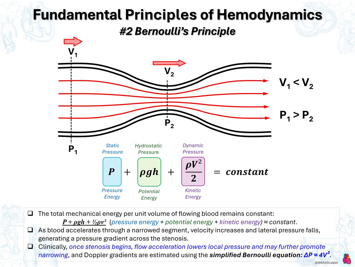 WithAScalpel's tweet photo. Fundamental Principles of Hemodynamics: Bernoulli, Poiseuille & Flow Regimes

👉Bernoulli’s principle links velocity and pressure: flow acceleration through stenosis lowers lateral pressure; Doppler uses ΔP ≈ 4V².
👉Hagen–Poiseuille’s law shows Q = πr⁴ΔP/(8μL), making vessel, shunt, conduit, or cannula radius a dominant determinant of flow.
👉Laminar flow is orderly; turbulence is favored by ↑velocity, ↑diameter, and ↓viscosity, increasing energy loss and abnormal wall shear stress.