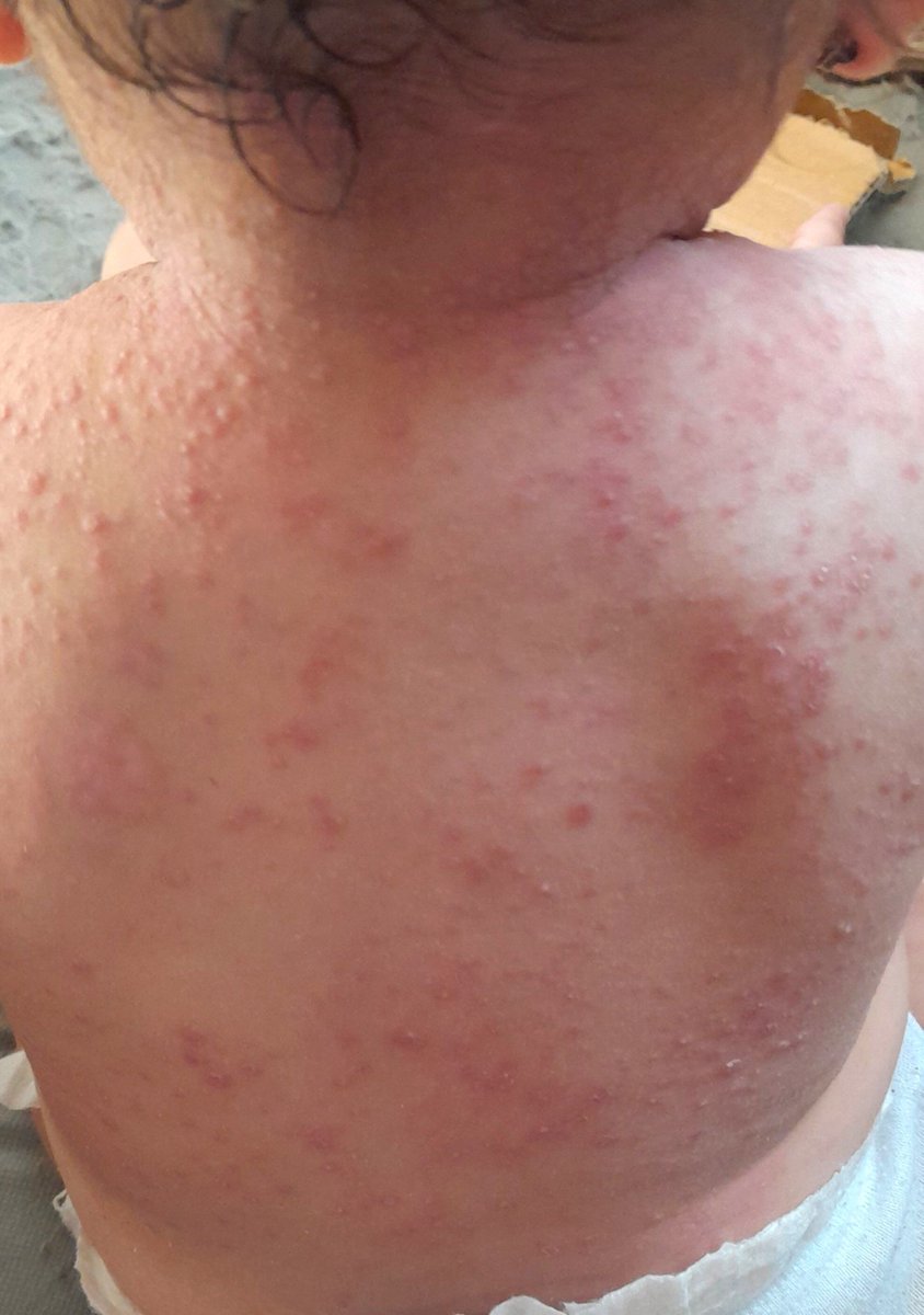 rola_almoghrabi's tweet photo. Unfortunately, no one cares 😭

︎
︎

︎

︎

︎

︎
︎

︎

︎
︎

we’ll remind you
︎

︎

︎

︎

︎
︎

︎

︎

︎

︎
︎

︎
︎

︎

︎
︎

︎
that
︎

︎

︎

︎

︎

︎

︎

I desperately need TREATMENT.  Scabies is spreading on my child's body 😭
https://t.co/FLk3iM7URh https://t.co/HbtlZ31wfv