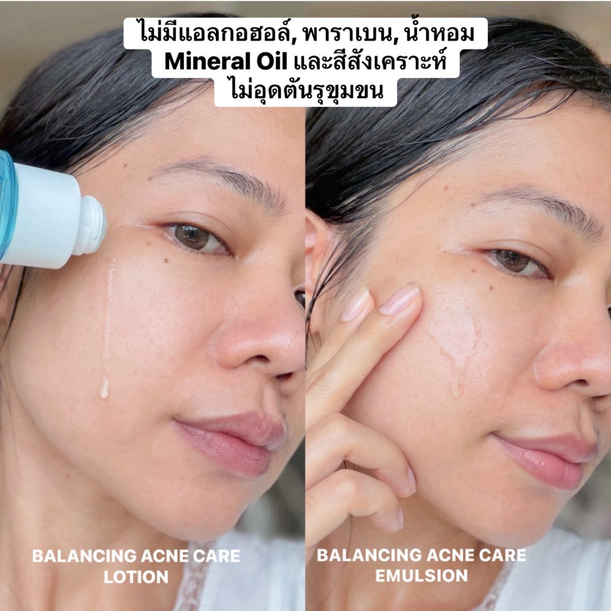 ChaliReviews's tweet photo. ใช้ตั้งแต่สูตรเก่า จนตอนนี้เปลี่ยนเป็นสูตรใหม่ก็ยังใช้อยู่ คือถ้าไม่ดีจริงไม่มีซ้ำแน่นอน ช่วงนี้สิวขึ้น ผิวแพ้ง่ายก็ใช้สูตร สีฟ้า ช่วงเรื่องสิวดีมากๆ ลดหน้ามัน รูขุม���นกระชับ ผิวแข็งแรงขึ้น จนตอนนี้สิวหาย แล้ว ไปลองง

#dprogramThailand https://t.co/cJDJQWD1L2