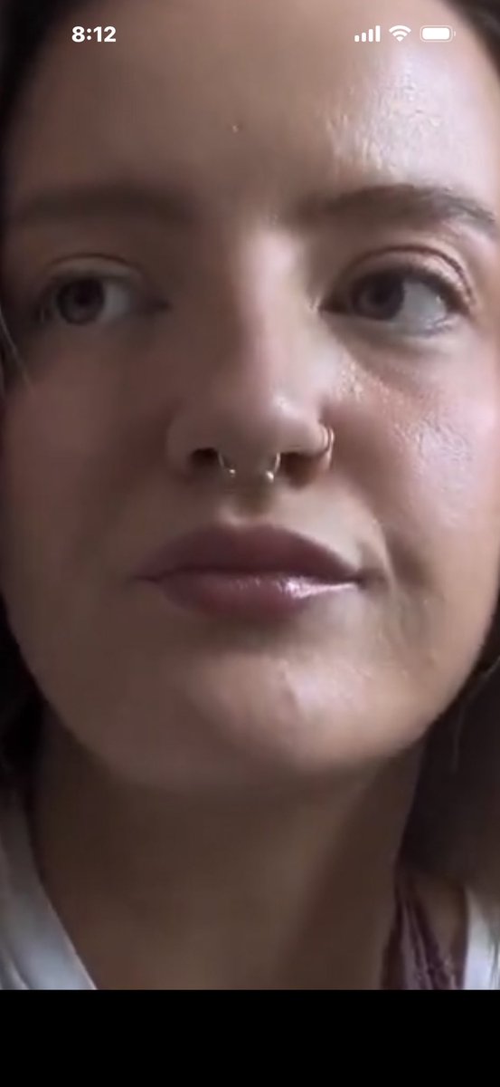DexterOfX's tweet photo. @sp4rkl3jumpr0p3 The face of racism and modern stupidity https://t.co/Dvp5d5FIct