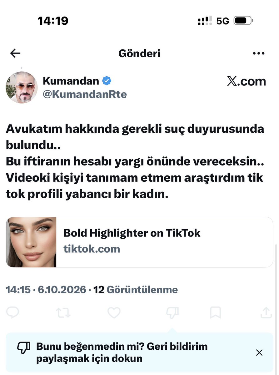Albayimm0's tweet photo. Aha bak ka*cık  bunu söyler demedin mi size :) https://t.co/Q264U2ZdAB