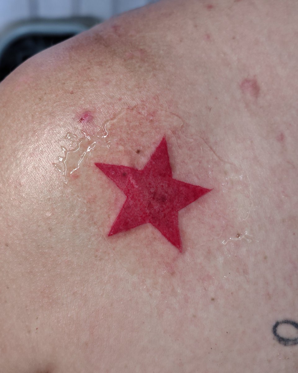 dxsintegration's tweet photo. E minha tia que me fez tatuar essa estrela nela https://t.co/KDqv7oHapT