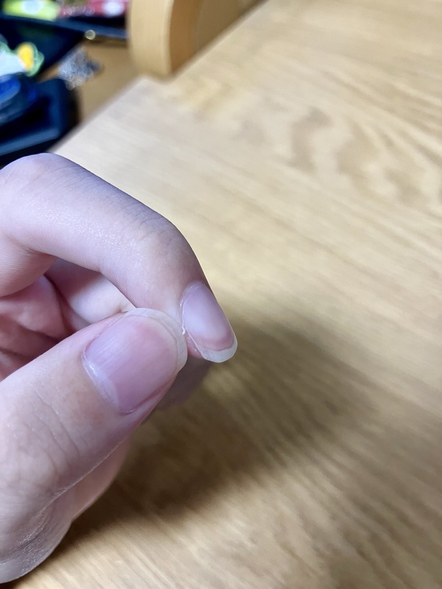 TKG_Lv2's tweet photo. 今年も来たよささくれの時期😭😭😭 https://t.co/ofdqoZjAV5