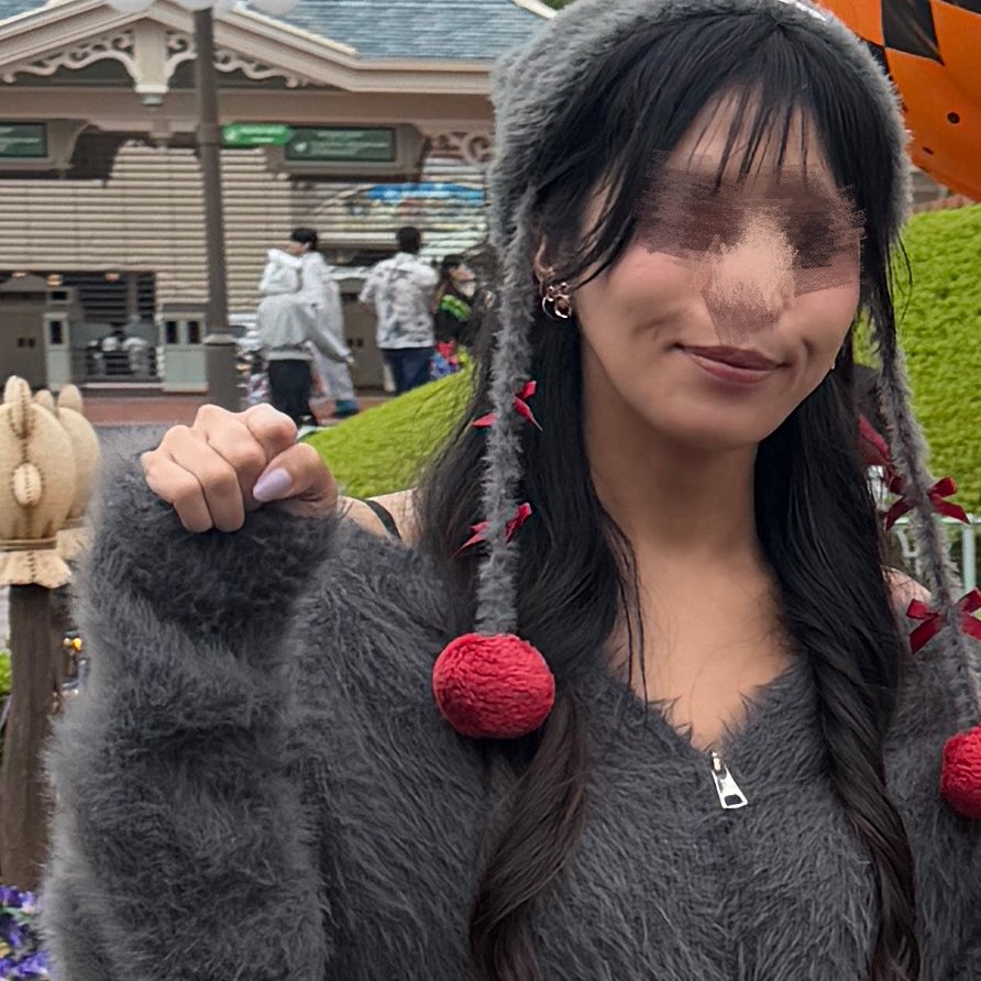 h210731's tweet photo. 糸リフトから1ヶ月経ったけど頬の糸の硬いのは変わらない
凹みはなくなったけどばばあ感も別に消えない
えーーー術前の丸みあった方が若く見えたとかある？ https://t.co/fAigmf77di