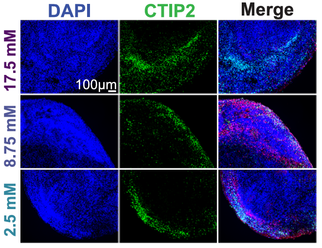 UCLANeuroTheme's tweet photo. How does a developing brain decide which kinds of cells to make? A @dgsomucla-led study from Dr. Aparna Bhaduri and Dr. Heather Christofk’s labs found that metabolism may help guide that process. Using developing human brain tissue and lab-grown brain models, researchers found that changing glucose availability shifted which types of brain cells formed. The image shows fluorescently labeled cells in the brain models under different glucose conditions, helping researchers see how the mix of developing cell types changed. Read more: https://t.co/NquEUpKJpd. #UCLA #Neuroscience #BrainResearch