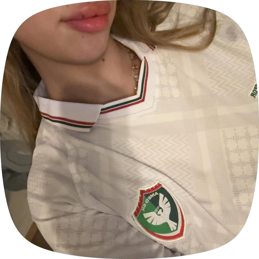 TurkWolf888's tweet photo. Kurdish lips. 

Do these people not have any self-awareness? ��� https://t.co/KyInqBGFyr