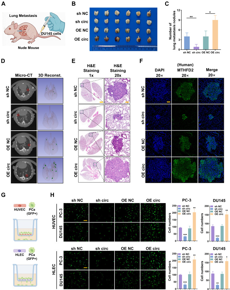 ASPET's tweet photo. In JPET's editor's choice, data provides multiple potential pharmacological targets to prevent prostate cancer metastasis, and circDOPEY2 can be used as a biomarker to track the increased likelihood of prostate cancer metastasis. Read the research: https://t.co/JG5Q6C6Qi5 https://t.co/pyWDhQhdPE