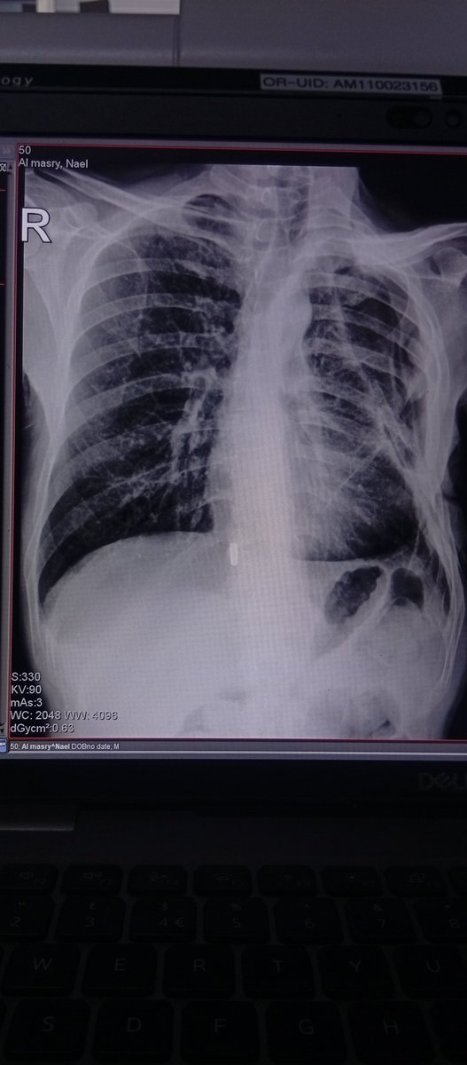 Nevinalmasri79's tweet photo. "Greetings, my brothers and sisters 🥺🤲
I ask you to help me create a new donation campaign… my previous one was stolen by a liar and a fraudster… please do not leave me alone… my husband and my injured children are waiting to be saved… save us 🇵🇸💔" https://t.co/T7C9pzcxtL