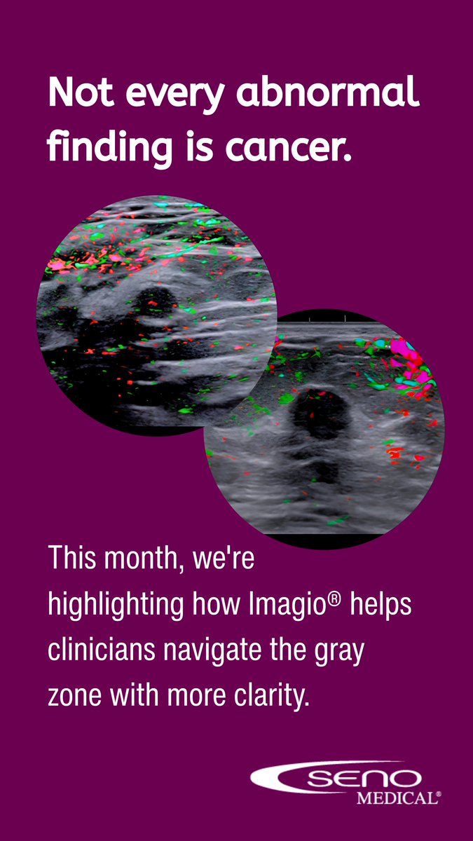 senomedical's tweet photo. Not every abnormal finding is cancer. 

This Breast Cancer Awareness Month, we're focusing on that space between clearly benign &amp; clearly suspicious &amp; how additional functional information may help clinicians navigate it. 

The gray zone deserves a closer look with OA imaging. https://t.co/gLCX549ejP
