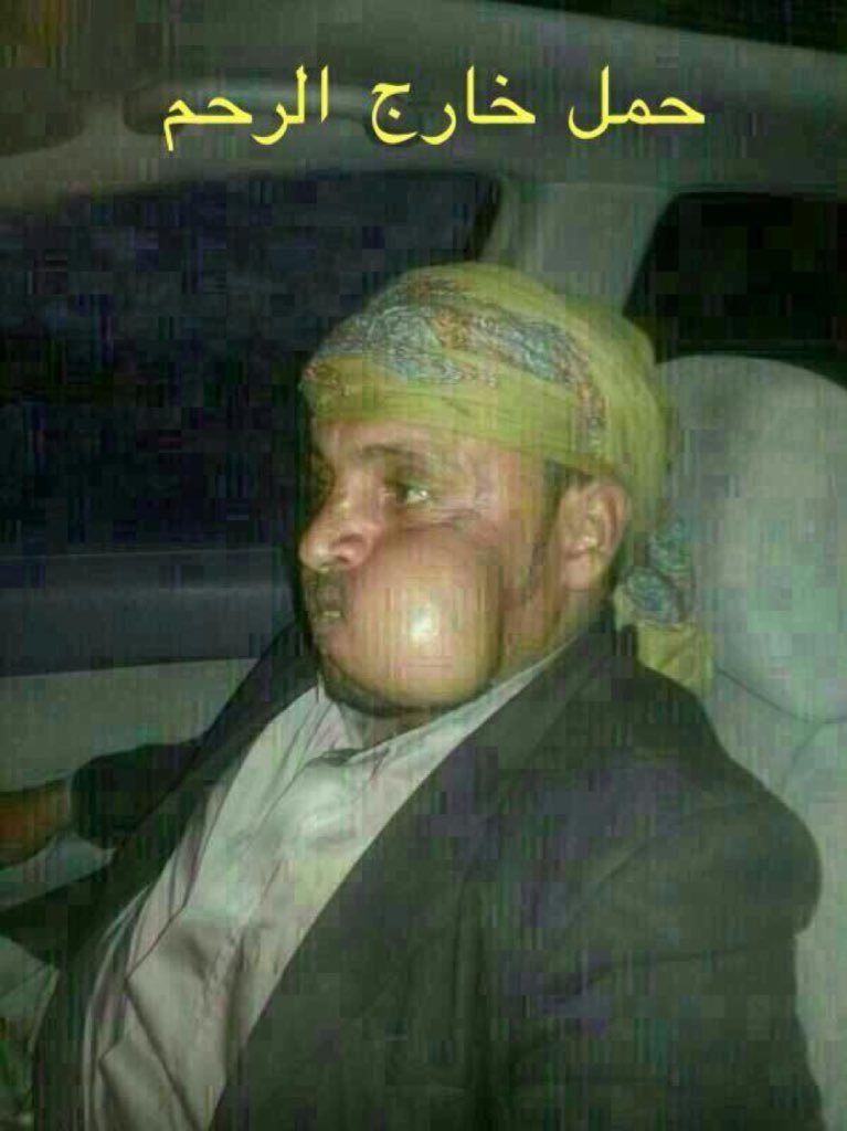y_1416l's tweet photo. @atgahak اوييييلي عليك ياحسناء القحطاني هههههههههههههههههههههههههههههههههههههههههههههههههههههههههههههههههههههههههههههههههههههههههه https://t.co/xw4hUTRGfr