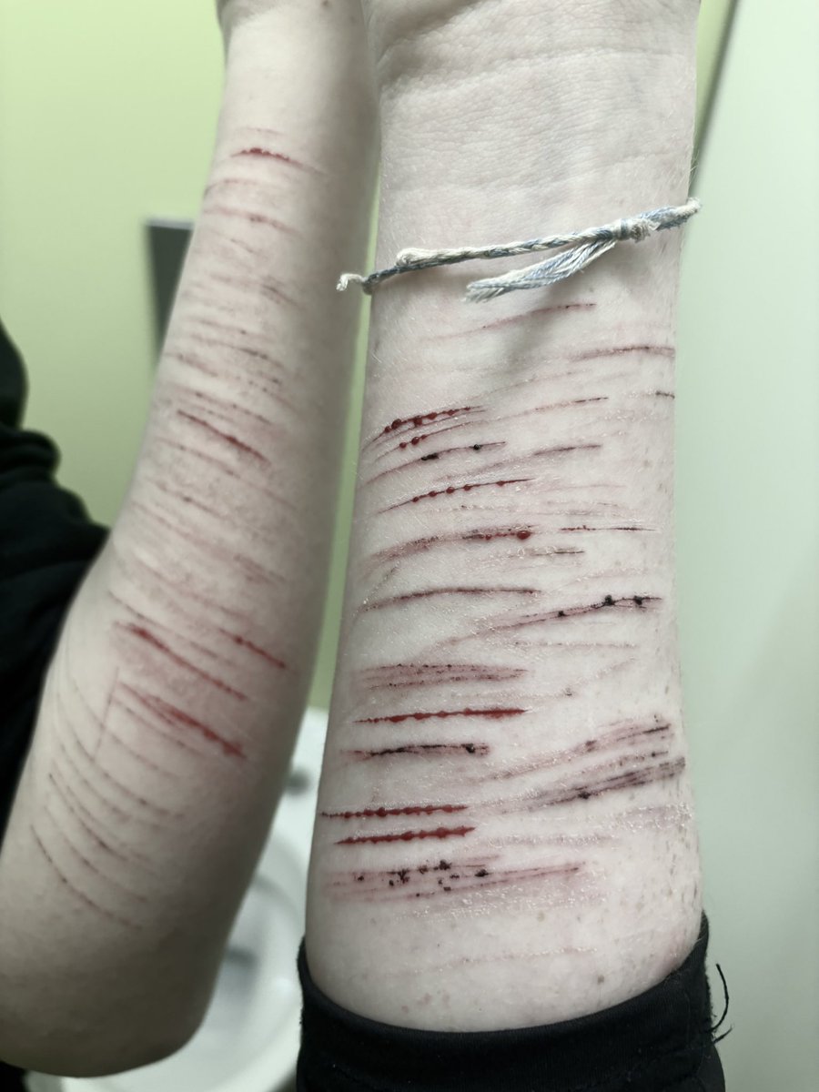 cvtcvtsh's tweet photo. Look what ive made at schooll!! All fx makeup training for halloween ! ( do not reproduct ✌🏻😭) 
#shedtwt #cvt #shh #fx #988twt https://t.co/zbupJ0KA1o