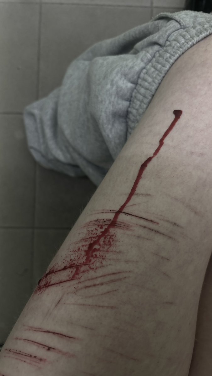 cvtcvtsh's tweet photo. Look what ive made at schooll!! All fx makeup training for halloween ! ( do not reproduct ✌🏻😭) 
#shedtwt #cvt #shh #fx #988twt https://t.co/zbupJ0KA1o