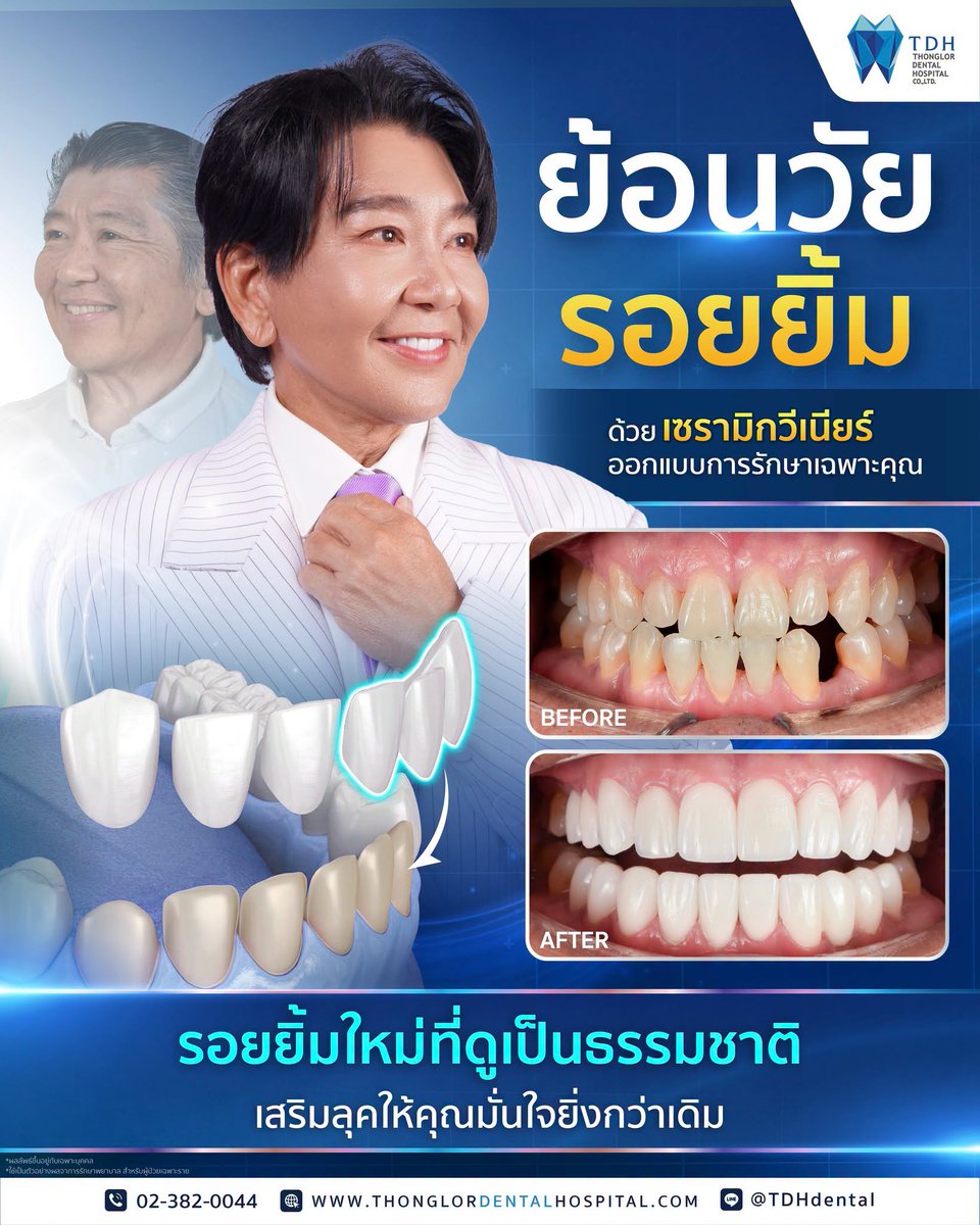 TDHDental's tweet photo. อยากหล่อในวัย 60+ ไม่ใช่ความฝันอีกต่อไป
คุณวันชัย | เจ้าของธุรกิจ ร้านอาหาร จ.ชลบุรี

ผู้ชนะการคัดเลือกเปลี่ยนโฉม
จากรายการ 𝙎𝙪𝙧𝙜𝙚𝙧𝙮 𝙒𝙖𝙧𝙨 𝙀𝙋.7
กับลุคใหม่ที่สะดุด��าตั้งแต่ใบหน้าไปจนถึงรอยยิ้ม 👀✨

#TDHDental #วีเนียร์ #หมอเปิ้ลTDH
#วีเนียร์สวยมั่นใจต้องTDH https://t.co/sLJC34p1Ma