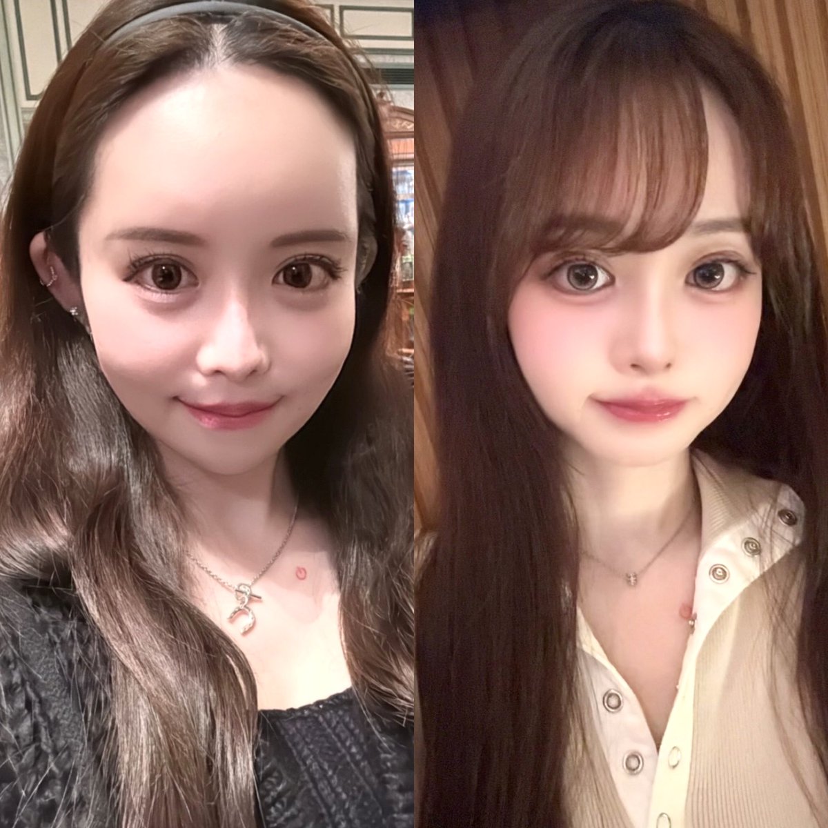 内視鏡額挙上、DT8ヶ月弱です。
ここ1年間でかなり可愛くなれたと思う。
去年の年末までは額ヒアルパンパンで涙袋もクマみたいだったし、
目と眉も近くて険しい整形顔だった。
額挙上して顎と涙袋のヒアル抜いて人間に戻りました。 https://t.co/RQS1oAwqs3