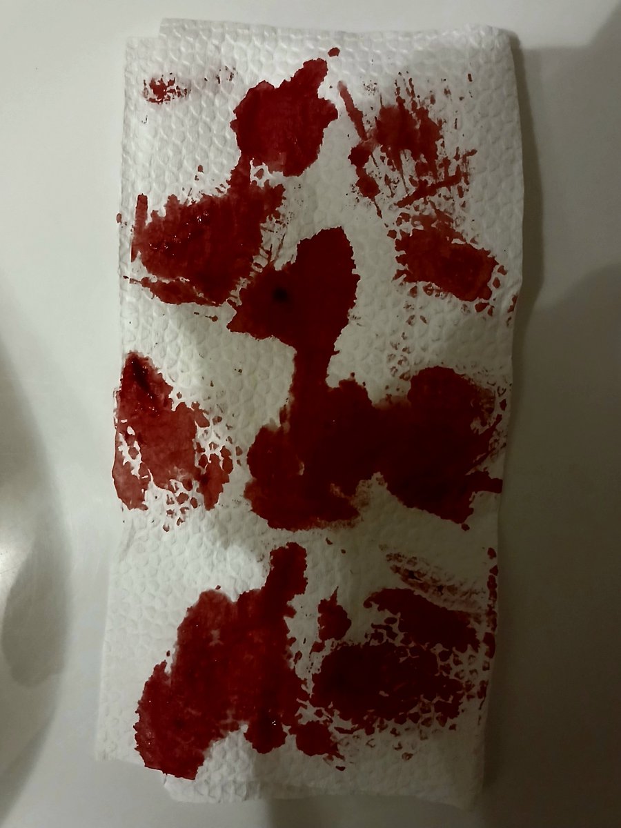 6leeding4u_'s tweet photo. Lame baby swipes cause I hella binged today and my stomach hurts SM from being bloated

ALL FAKE AI ENHANCED SFX MAKEUP. NOT PROMOTING. https://t.co/C0X1ZpKJH7