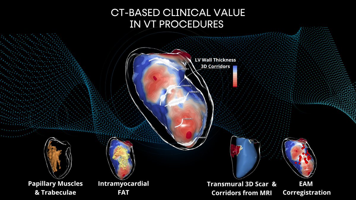 ADAS3D's tweet photo. We’re excited to be part of VT Symposium 2026 in New York! Join us on October 9–10 to connect with the #ADAS3D team and explore how advanced cardiac imaging and 3D visualization can support VT procedures.
📍 New York Marriott at the Brooklyn Bridge
#VTSymposium2026 #Epeeps https://t.co/3nyzYDvRZq