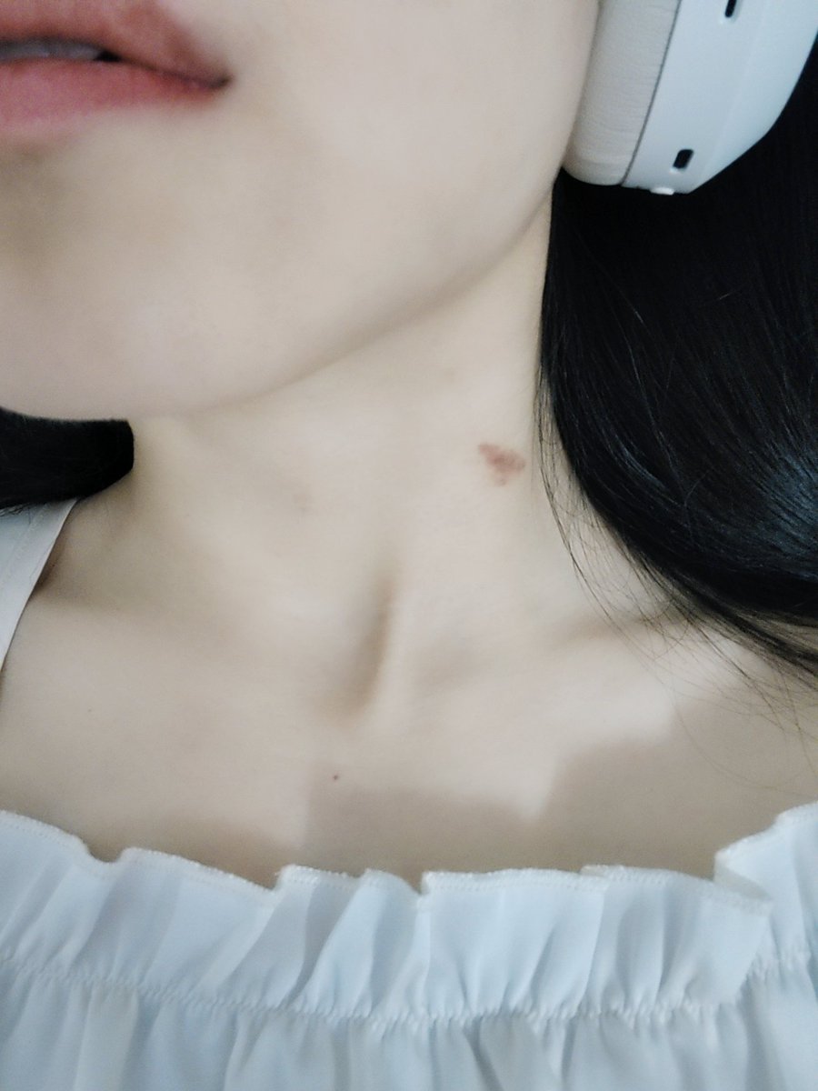 dogdou's tweet photo. 假期像尿一样流走了😢😢
求一键回到中秋节前教程🥹

我服了搓澡给自己搓出个草莓印
😅真有力气
#假期结束 #sub #不想上班 #不想上学 #小狗日记 https://t.co/okId6Mt3y0