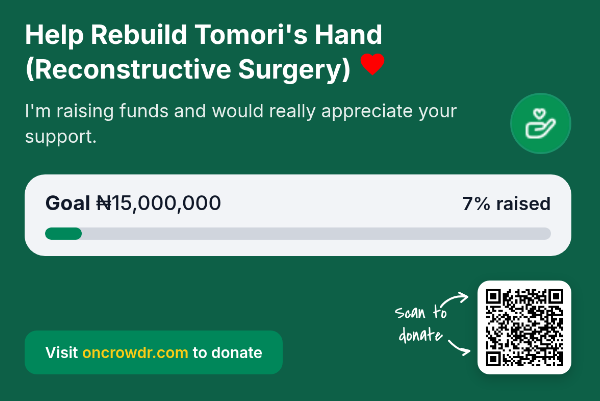 tomori8701's tweet photo. @TunjiDisu1 @ruffydfire A BIG THANK YOU to all who have contributed to my endeavor! God bless you😥

0120948401
GTBank
E.G.Tomori

The fundraiser link is in my Bio.
Thank You.✊✊✊ https://t.co/CpzaU38olg
