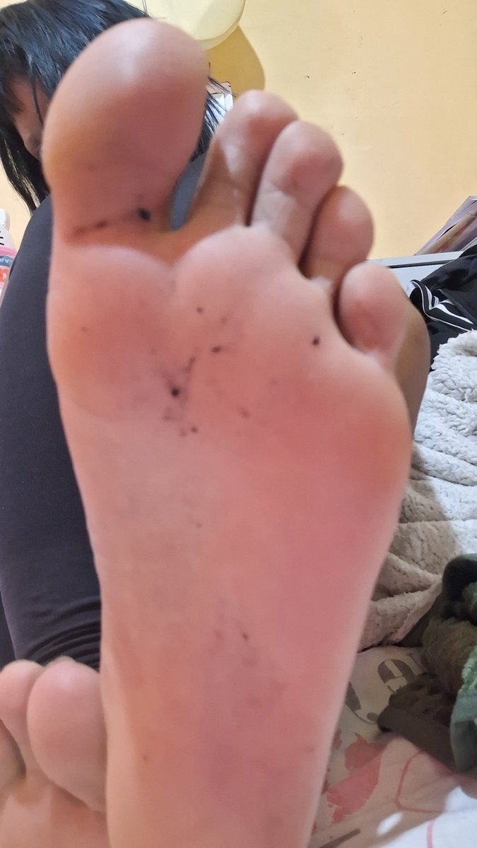 smorcegona's tweet photo. para a infelicidade de alguns. eu namoro um homem q adoro meus pezinhos 🤪🤪🤪

#feetfetısh #feetworshi̇p #pezinhos #solinhas https://t.co/tvoWX2ohlh