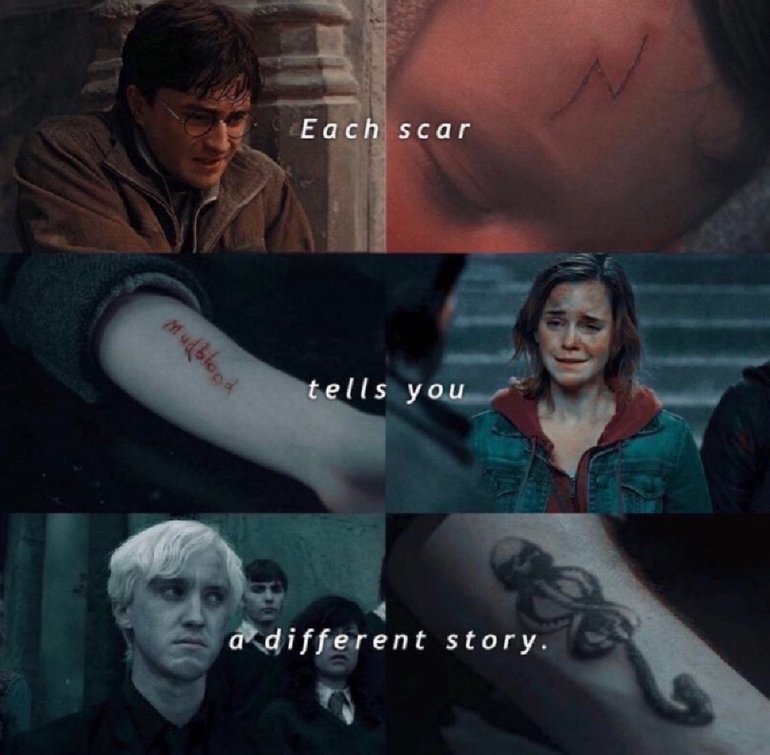 TheDailyHPotter's tweet photo. Each scar tells you a different story 👀 https://t.co/tERUy3HgRe