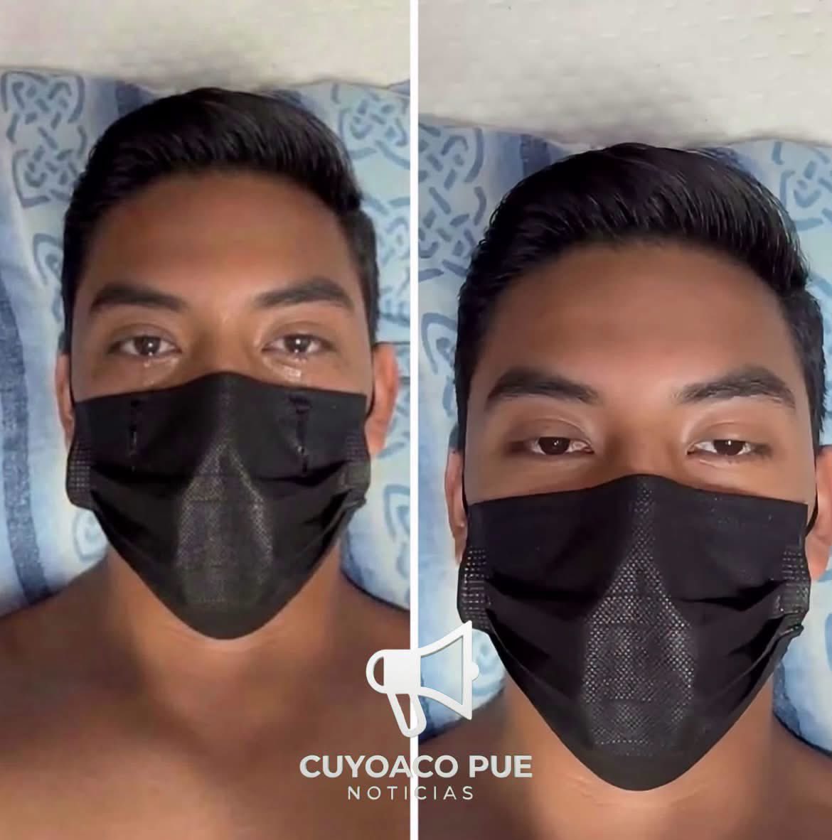 VigiaCiudadano7's tweet photo. 🚨LO APUÑALARON POR DEFENDER A SUS COMPAÑERAS Y PODRÍA SALIR LIBRE QUIEN LO HIZO.

Comparte por favor 

Eduardo, un joven de TLAXCALA que todos describen como tranquilo y respetuoso..

Estaba en la escuela como cualquier otro día cuando notó que un compañero de nombre VÍCTOR estaba lastimando a dos compañeras..

Al principio y pensando en que estaba jugando Eduardo solo observó de lejos pero al ver que VÍCTOR NO se detenía y las compañeras ya le habían pedido en varias ocasiones que las dejara en paz.. decidió enfrentarlo.

Molesto ante la situación VÍCTOR se volteó y de su mochila sacó un cuchillo.

“Jamás pensé que se atrevería pero no le importo.. aun habiendo testigos.. me APUÑALO DOS VECES.. mi cuerpo dejó de reaccionar.. entré en shock.. el solo tomó sus cosas y se fue”

Rápidamente los que estaban cerca pidieron ayuda y lograron llevarse a Eduardo.. le practicaron cirugía por más de 8 horas..

Su riñen y estómago habían sido lastimados pero afortunadamente estaba estable..

Cuando despertó de la cirugía vino la peor noticia.. SI, HABÍAN AGARRADO A VÍCTOR pero aunque las heridas habían sido graves..

Sus abogados lograron que no se llevara el proceso como “INTENTÓ DE H0MICIDIO” a solo “LESIONES AGRAVADAS”

Dándole como máximo a Víctor 2 años preso y con posibilidad de salir pronto bajo fianza.

Eduardo comenta que desde lo sucedido.. tanto el como su familia han enfrentado diferentes “extorsiones” en las que por una cantidad económica les piden dejar el asunto por La Paz e incluso diciéndoles que de no hacerlo se enfrentarían a lo que venga..

“Fiscalia está informado de todo y aun así no se han movido.. mi familia y yo somos trabajadores honrados de bajos recursos y es por eso que nos han ignorado.. quiero que mi caso se de a conocer por si algo me pasa a mi o a los míos y que TODOS sepan que me fallaron y que protegieron a VÍCTOR”

¿Tú qué piensas?