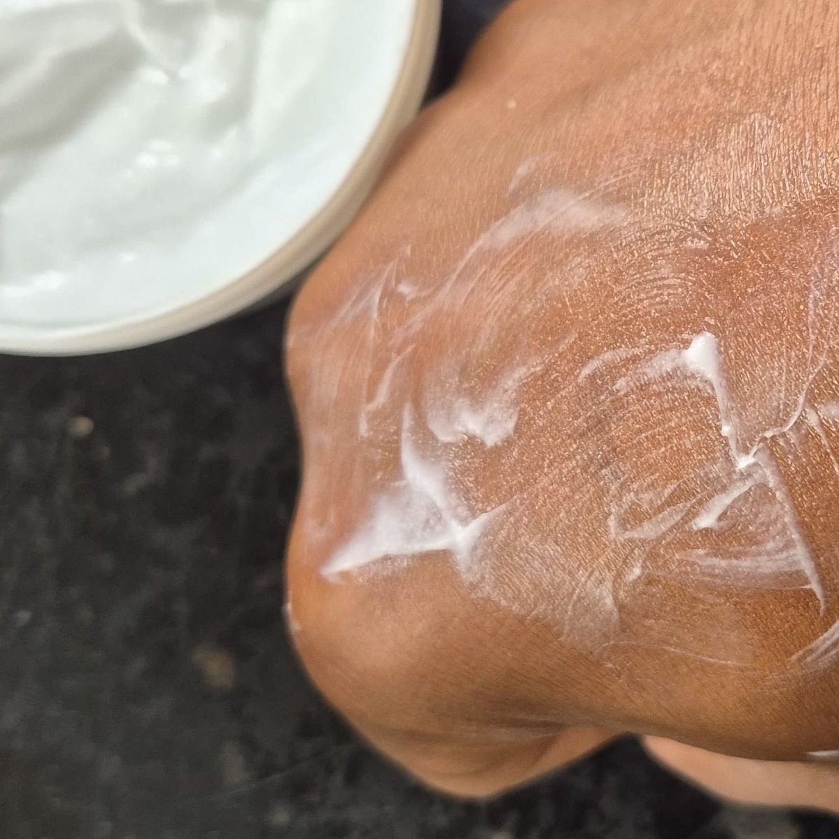 SabzerAzoh's tweet photo. GENTLY MOISTURISES WHILE HEALING AND SOOTHING THE SKIN:
New skin repair cream made from uFudu lweNtaba plant🌿 for eczema, psoriasis, skin cancer, acne, wounds, burns, ulcers, blisters, insect bites, hyperpigmentation, blemishes, chubaba, nappy rash, and wrinkles. Helps maintain clean, healthy, revitalised skin and promotes healthy blood circulation. Environmental friendly. For more dm.🍃🫶🏽