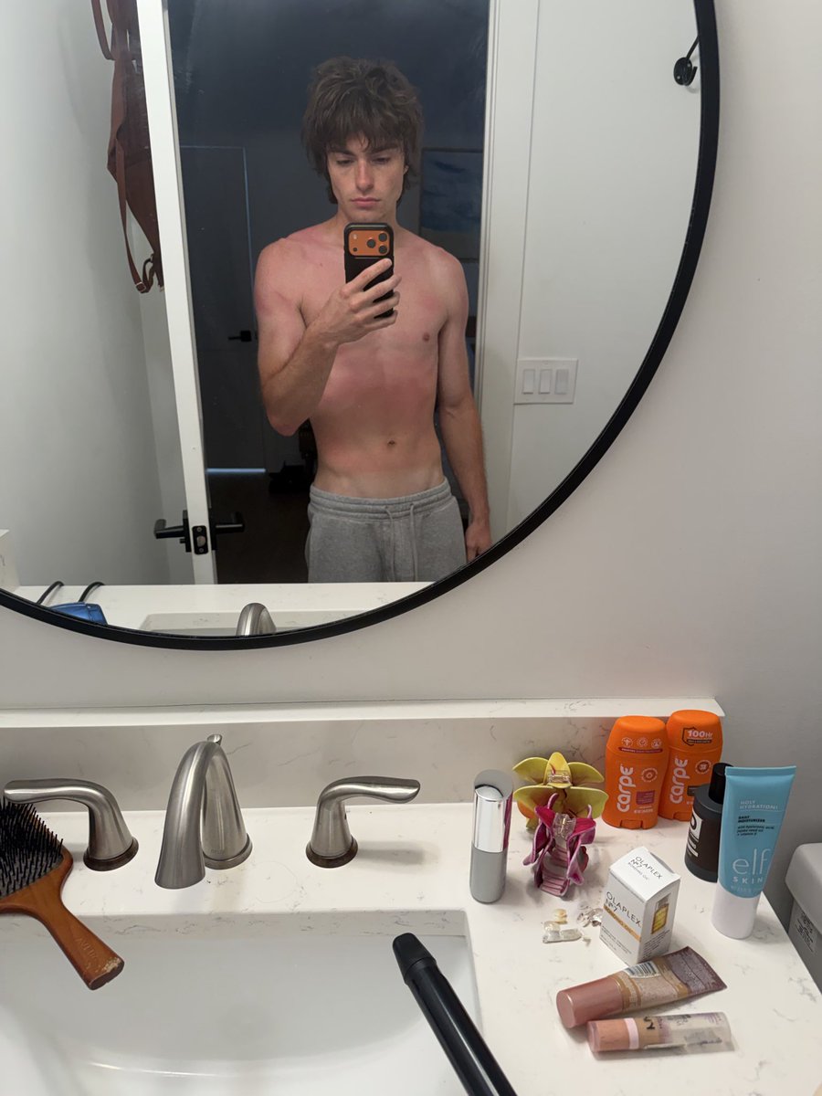 queefvape's tweet photo. I miss Florida but I got absolutely cooked by the sun https://t.co/nFERwto73O