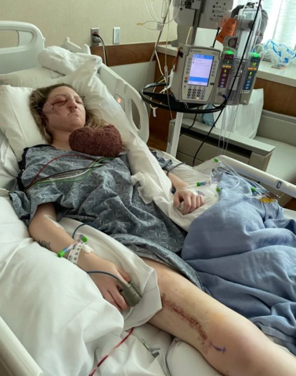 Natalie9c's tweet photo. 💔 Face cancer changed my life overnight. I’m facing a difficult treatment journey and overwhelming medical costs, but I’m holding onto hope. 🙏

Please consider donating or sharing my story. Your support could help me keep fighting. https://t.co/Z2vzj0goV9