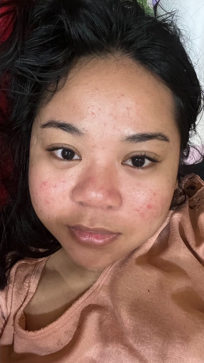 messsyy91's tweet photo. dia reach out balesin chat2 trs jelasin di vc tapi jujur aku ga nemu jawaban atas itu, malah cerita ngapain aja selama ini. aku mutusin buat menyudahi hubungan ini, tpi dia gamau dan ngalihin topik. selama call aku nangis 40mnt dan setiap jawab nangisku jadi lebih kenceng https://t.co/bLsGVtodKt