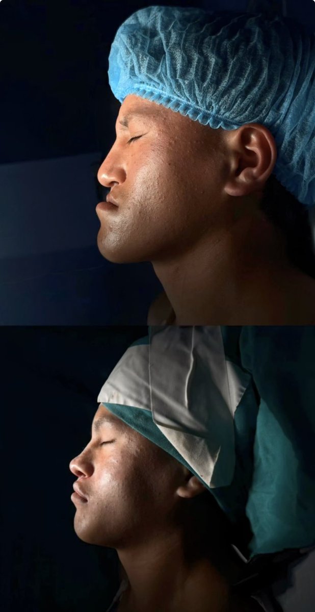piltrafasio's tweet photo. UFC fighter known as “Raul Rosas Jr” underwent a surgery before his match this weekend against Brazilian veteran Raoni Barcelos 😱
#UFC #MMA #UFCFIGHTNIGHT https://t.co/5nn1Zq0kSu